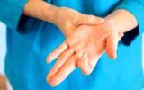 همستر کامبت شما را به این بیماری مبتلا می‌کند | سندرم انگشت ماشه‌ای چیست؟